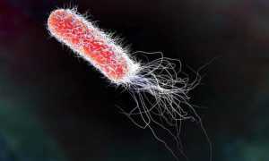 Лактозонегативная кишечная палочка e coli что это такое