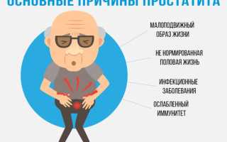 Бактериальный простатит — что это такое? Врачи рассказали о всех рисках заболевания