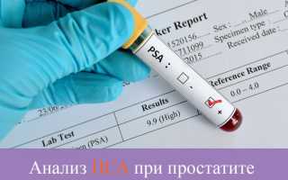 Что может рассказать анализ ПСА при простатите?