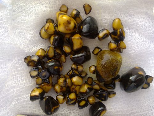 Лечение холелитиаза Цвет камней в желчном пузыре