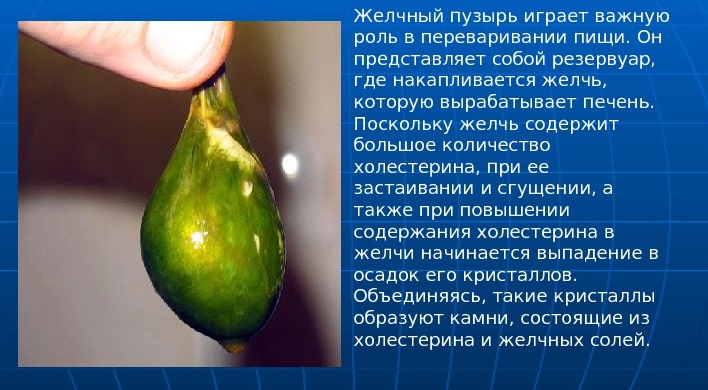 Зачем организму желчь? Роль желчного пузыря в организме