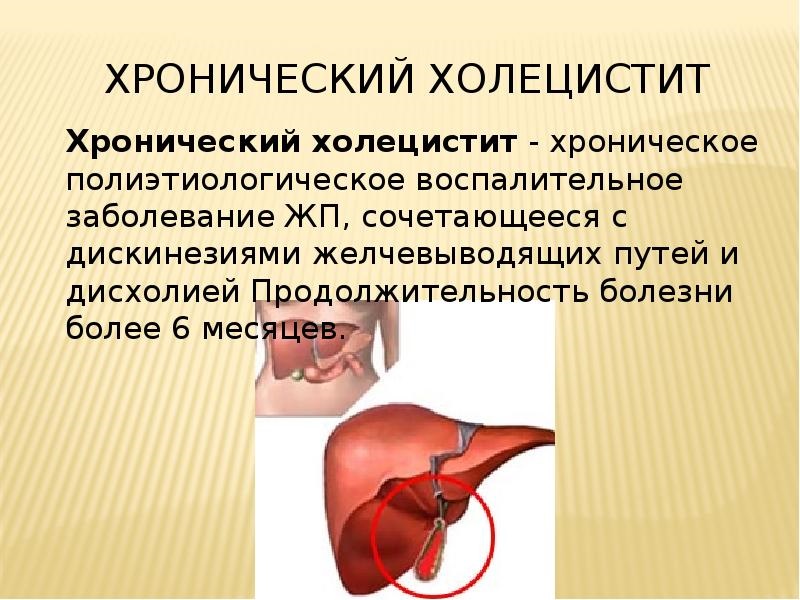 Холецистит в острой и хронической форме Энтерогенные заболевания печени и желчного пузыря