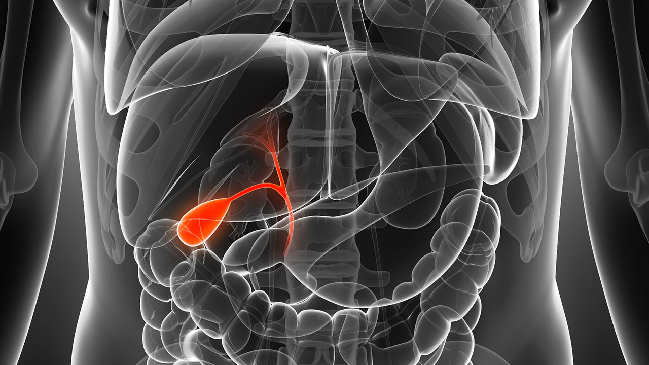 К чему приводит удаление этого органа? Сколько живут после удаления желчного пузыря?