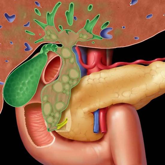 Как диагностировать закупорку желчевыводящих путей? Лечение непроходимости желчных путей