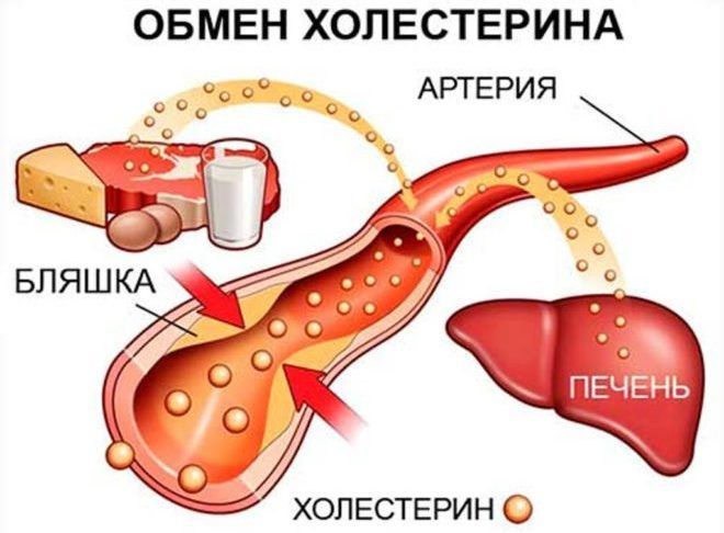 Отсутствие регулярного питания, как причина высокого холестерина Роль холестерина в возникновении желчных камней