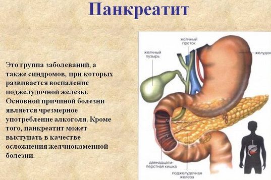 Лечение панкреатита при удаленном желчном пузыре Панкреатит после удаления желчного пузыря