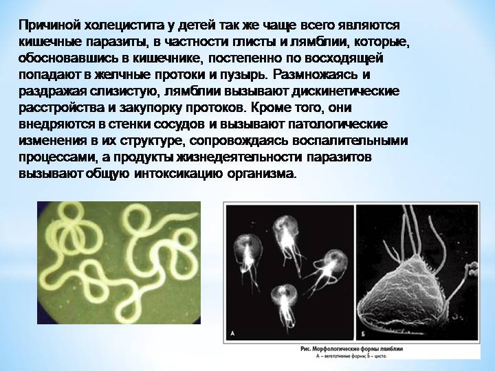 Лямблии в желчном пузыре Паразиты в желчном пузыре