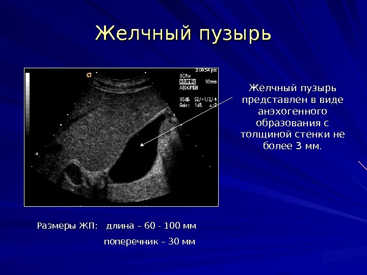 Каким образом измеряют и обследуют желчный пузырь? Размеры желчного пузыря