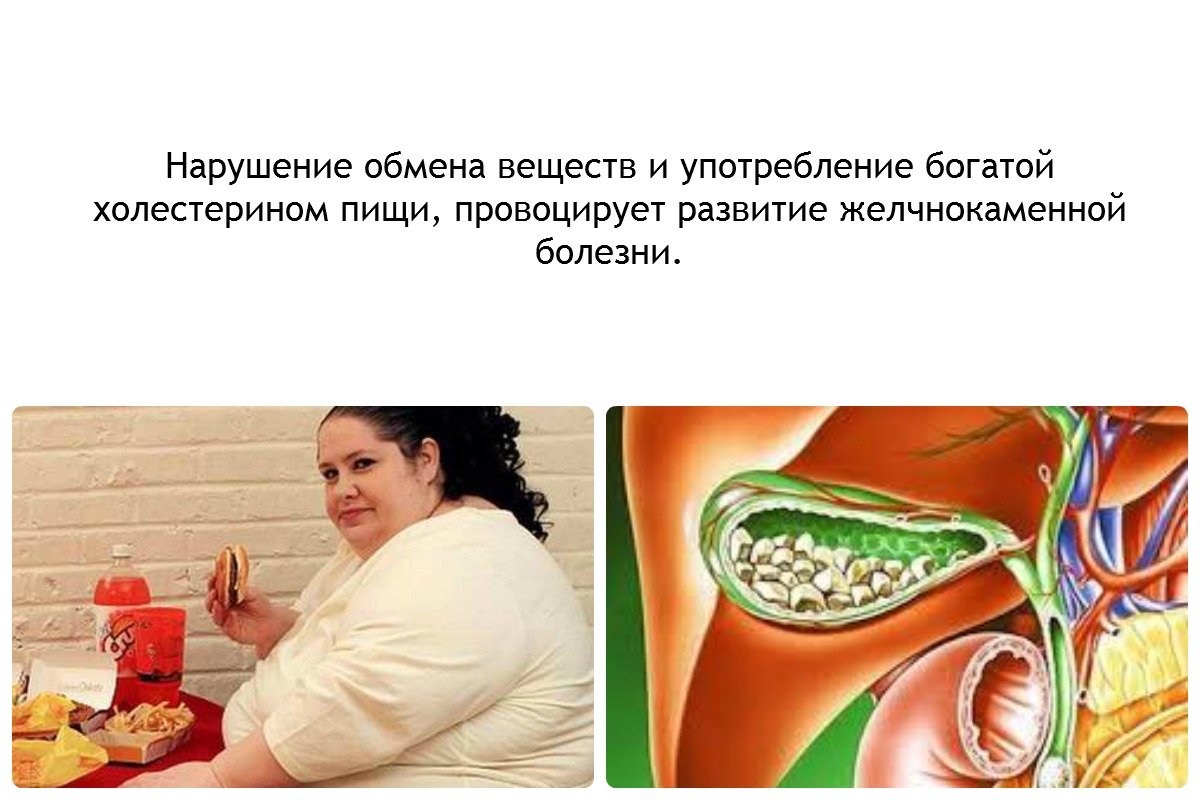 Острая форма холецистита Холецистит застой желчи