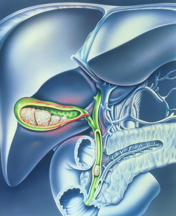 Лечение шыповником Шиповник после удаления желчного пузыря
