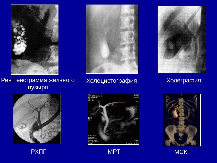 МРТ органов пищеварительной системы МРТ желчного пузыря