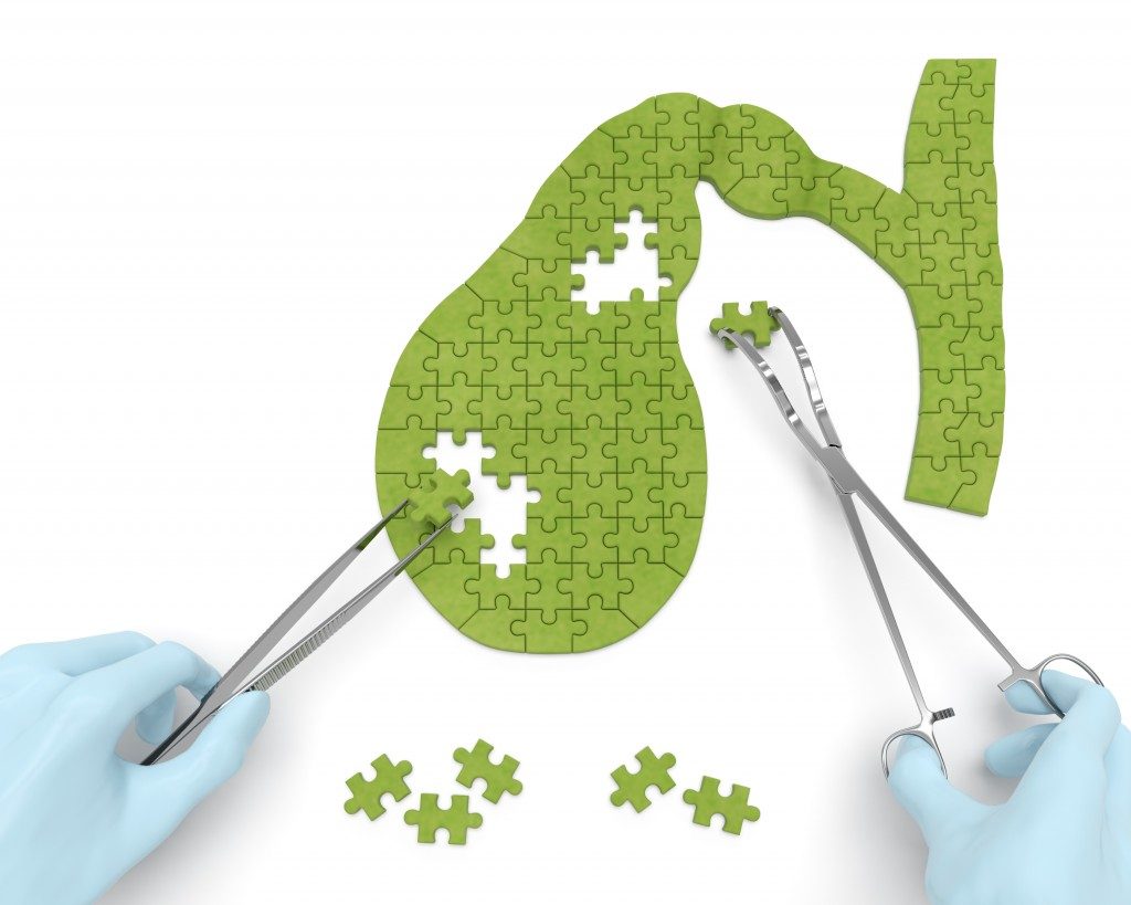 Нарушение сократительной функции желчного пузыря Дисфункция желчного пузыря