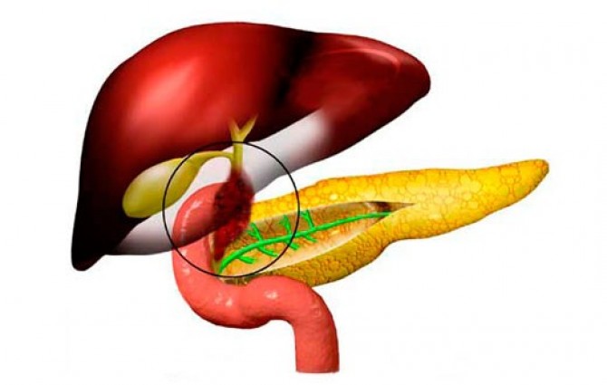 Особенности билиарной системы Дискинезия желчного пузыря
