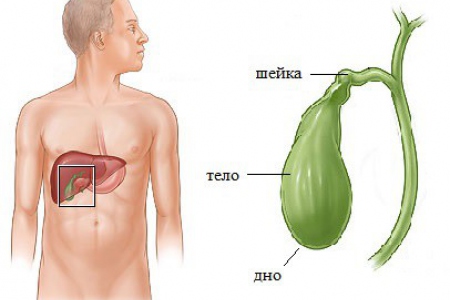 Загиб желчного пузыря Загиб желчного пузыря
