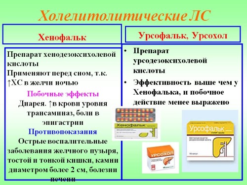 Препараты для лечения камней в желчном Чем лечить камни в желчном пузыре?