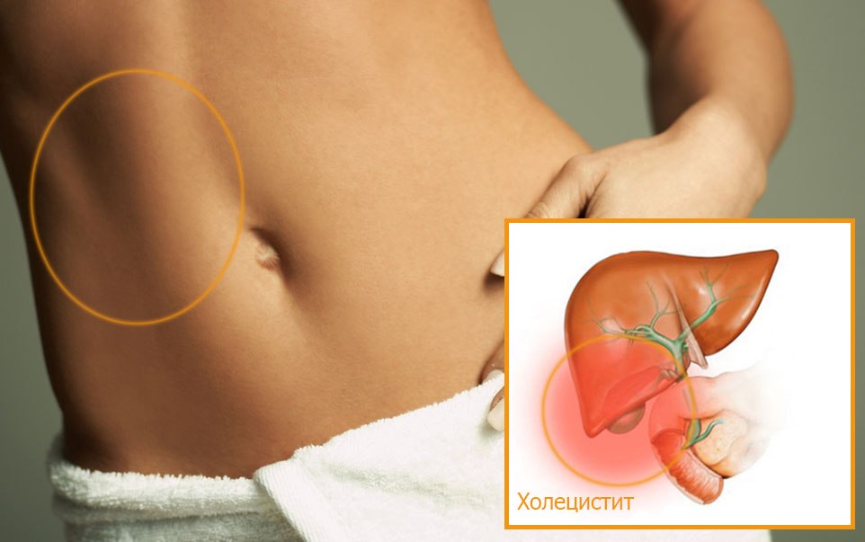 Симптомы холецистита Симптомы воспаления желчного пузыря у женщин