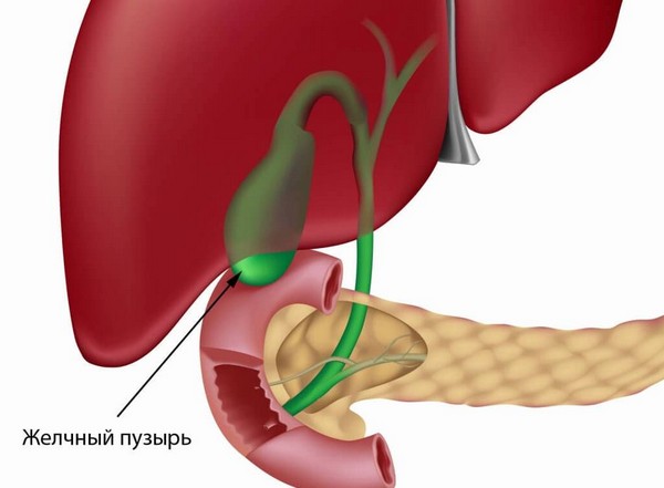 Когда такая операция необходима? Холецистэктомия