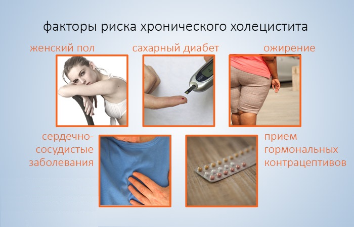 Хроническая форма холецистита Холецистит застой желчи