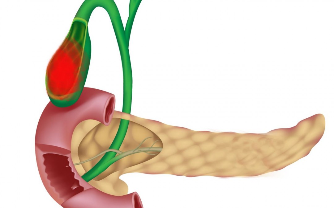 Чем опасно изменение состава желчи? Можно ли принимать Аллохол после удаления желчного пузыря?