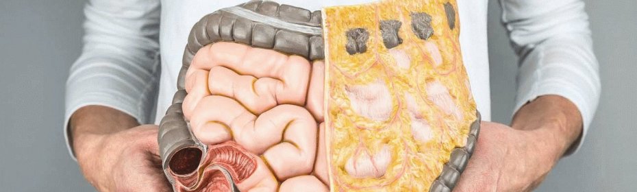 Непроходимость кишечного тракта Желчные камни в кишечнике