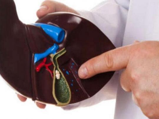 Способы удаления камней из желчного пузыря Чем лечить камни в желчном?