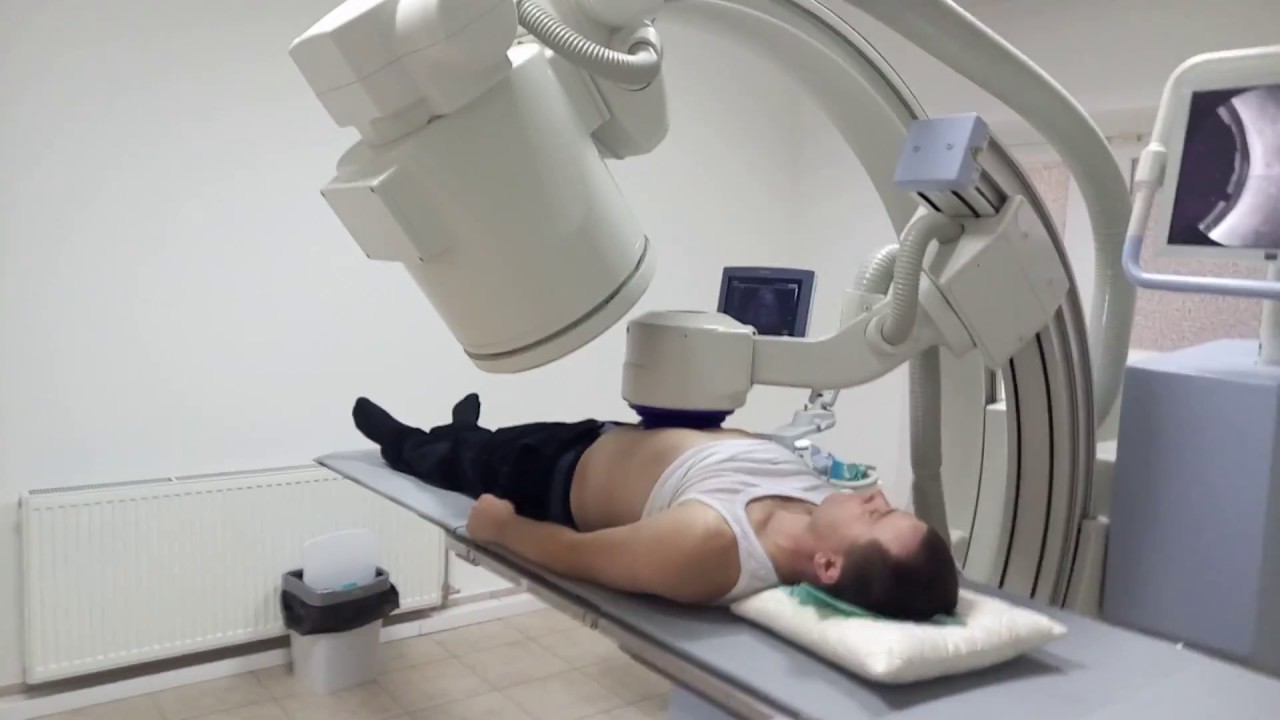 Возможные последствия литотрипсии Лечение лазером камней в желчном пузыре