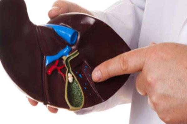 Почему обостряется желчекаменная болезнь? Что делать при приступе желчнокаменной болезни?