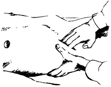 Тактики пальпаторного осмотра Пальпация желчного пузыря