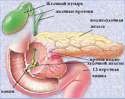 Симптомы камней в желчном пузыре Симптомы камней в желчном пузыре