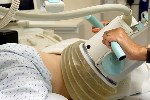 Механическая контактная литотрипсия Литотрипсия камней в желчном пузыре