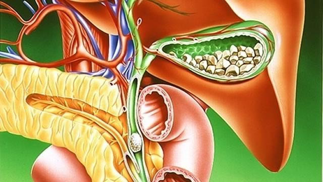 Латентная стадия желчекаменной болезни Диета при обострении заболеваний желчного пузыря