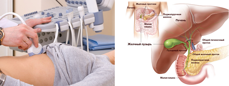 Холецистит - диагностика Холецистит застой желчи