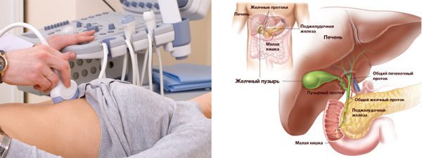 Способы лечения этой патологии Контактный литолиз желчных камней где делают