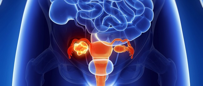 Эхогенность яичников Гиперэхогенная взвесь в желчном пузыре