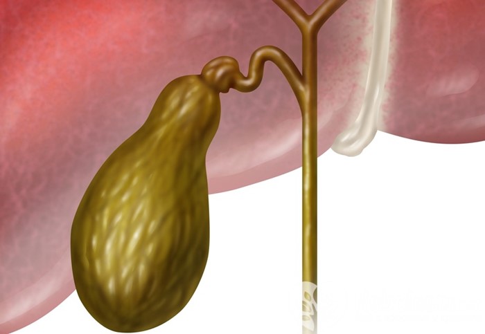 Патологии желчного пузыря КТ желчного пузыря