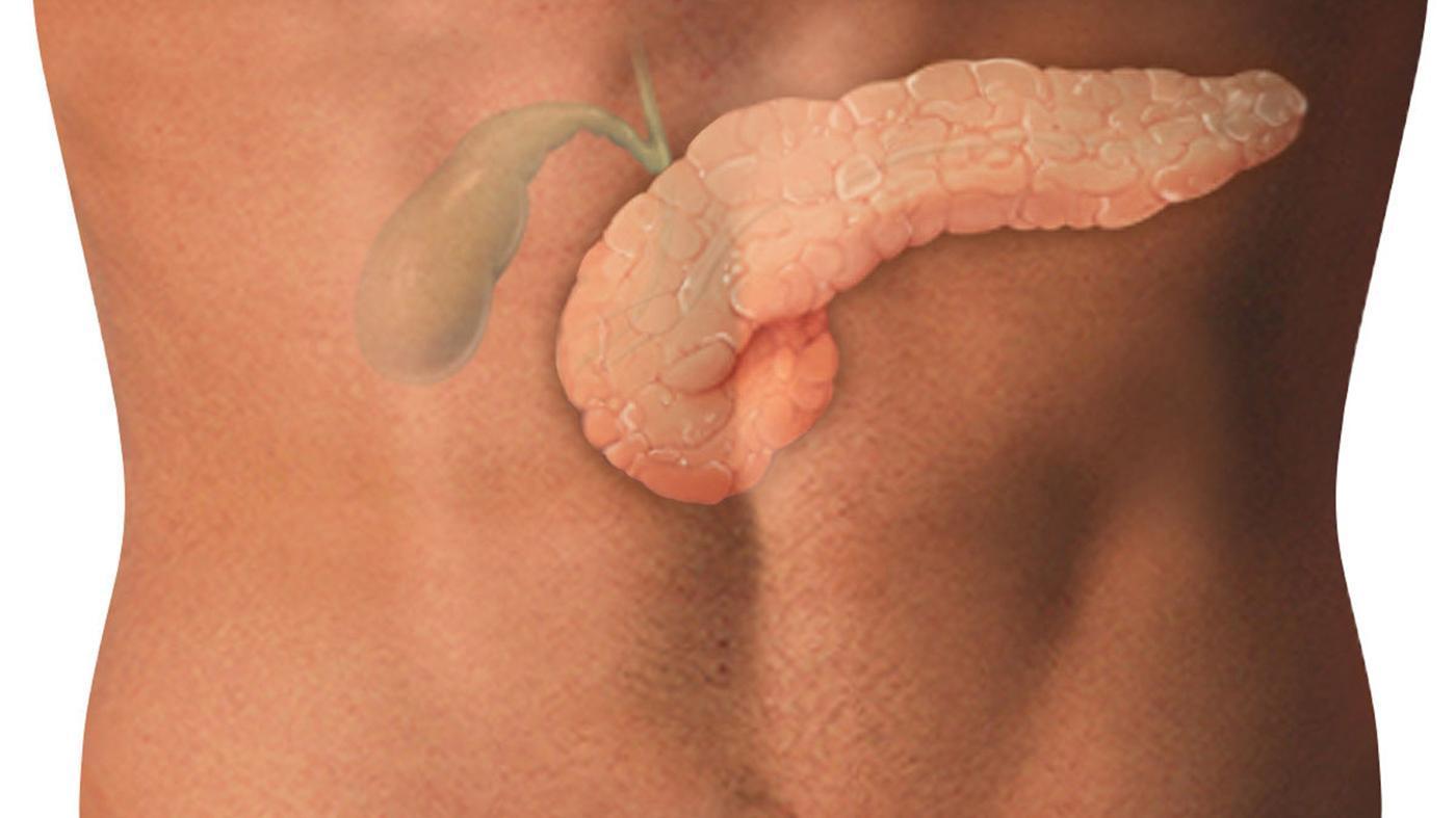 Осложнения после холецистэктомии Слабость после удаления желчного пузыря