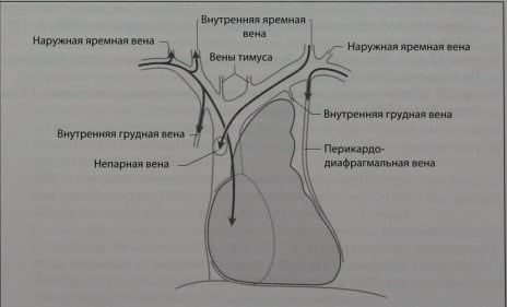 Снимки МРТ и КТ. Центральный венозный катетер