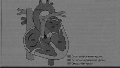 Снимки МРТ и КТ. Тетрада и пентада Фалдо
